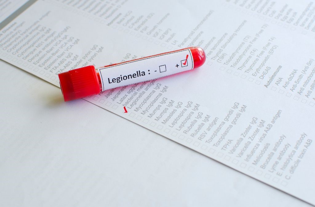 Désinfection eau contre la legionella